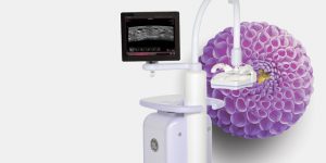 automated-breast-ultrasound